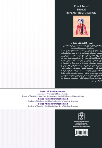 اصول کاشت تک دندان